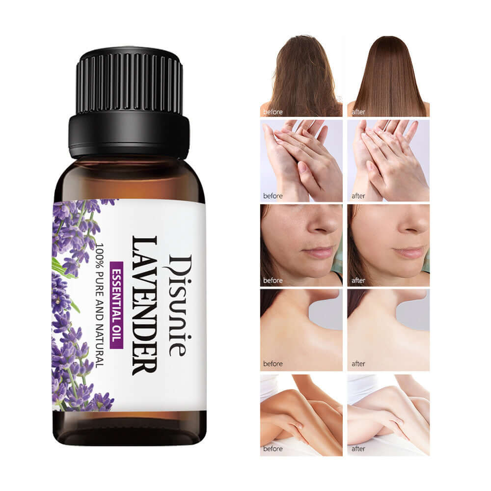 Disunie's Lavender Essential Oil 30ml for skin care, showcasing before and after results on various body parts.